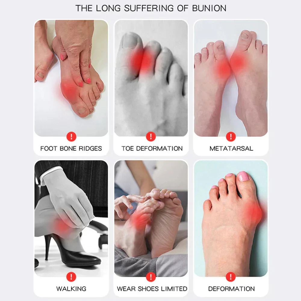 1+1 FREE | AlignaFeet – For naturally beautiful & pain-free feet - Image 5