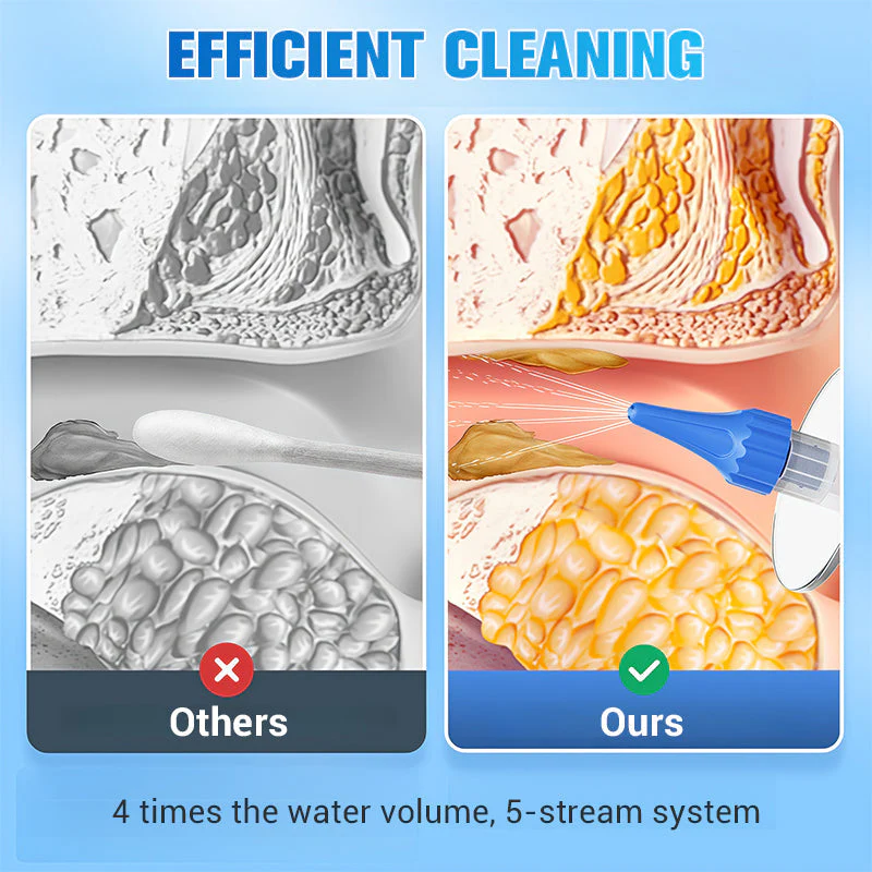 AquaClearJet – Safely Removes Earwax for Immediate Relief - Image 5