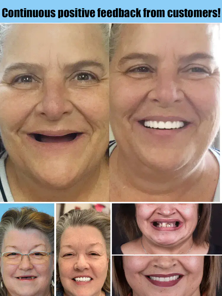 CharmSmile – Effortless Natural Comfort for Confident Smiles All Day Long - Image 5