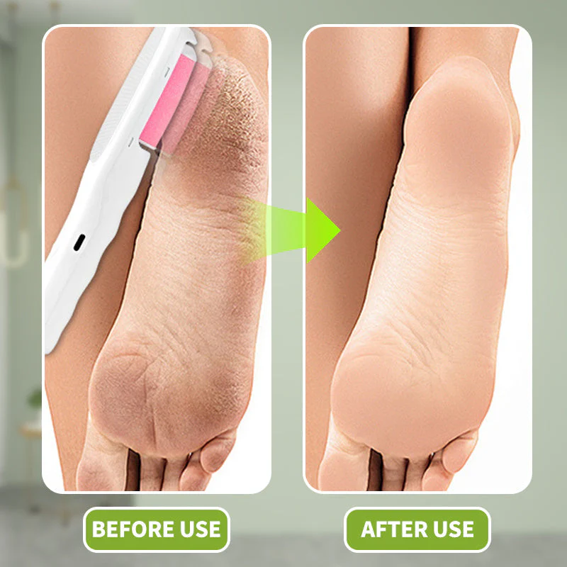 GlossyFoot – Instantly Smooth, Well-Groomed Feet and Hair Removal Anywhere - Image 6