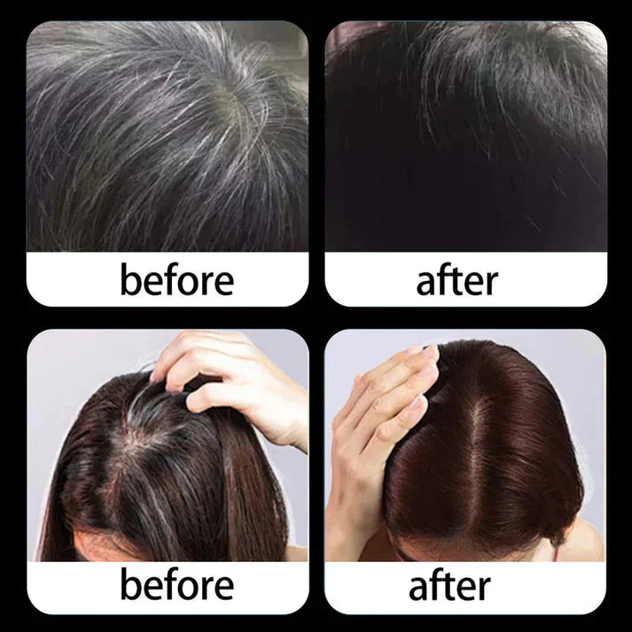 1+1 FREE | RootEase – Instantly Conceal Roots with Gentle, Chemical-Free Coverage - Image 4