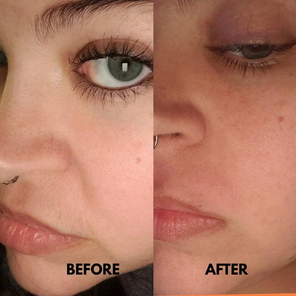SilkRooter – Gentle, Irritation-Free Facial Hair Removal with Long-Lasting Results - Image 3