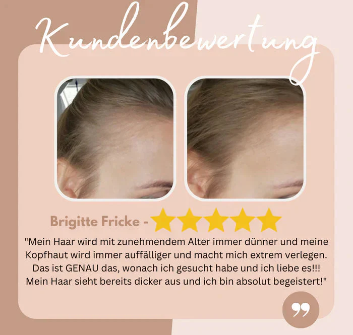 Unisex Hairline Filler | Natural Seamless Finish | Precision Applicator | Lasts Up to 12 Months - Image 6